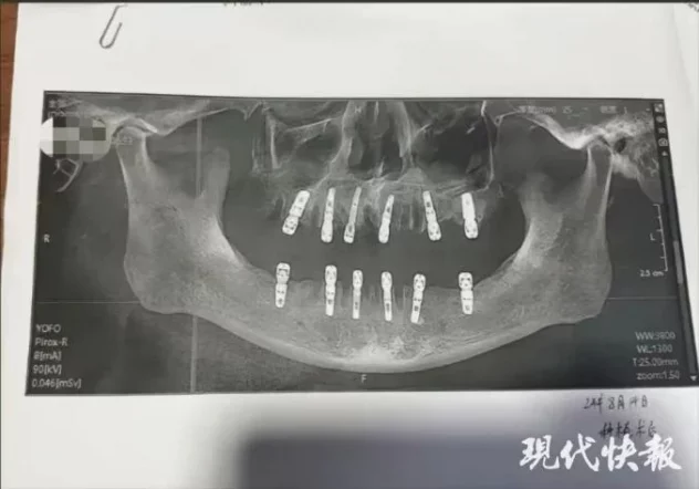 dental-scan